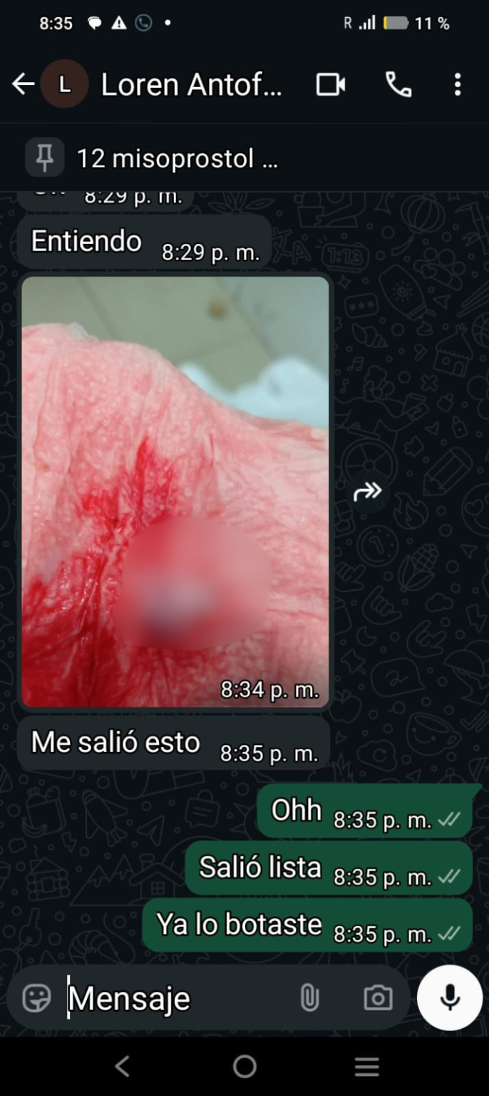 embarazo no planificado